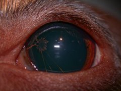 Persistierende Pupillarmembran
